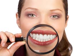 Snowhite Teeth Whitening - tanden bleken - ervaringen - kruidvat - waar te koop