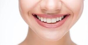 Snowhite Teeth Whitening - werkt niet - radar - review